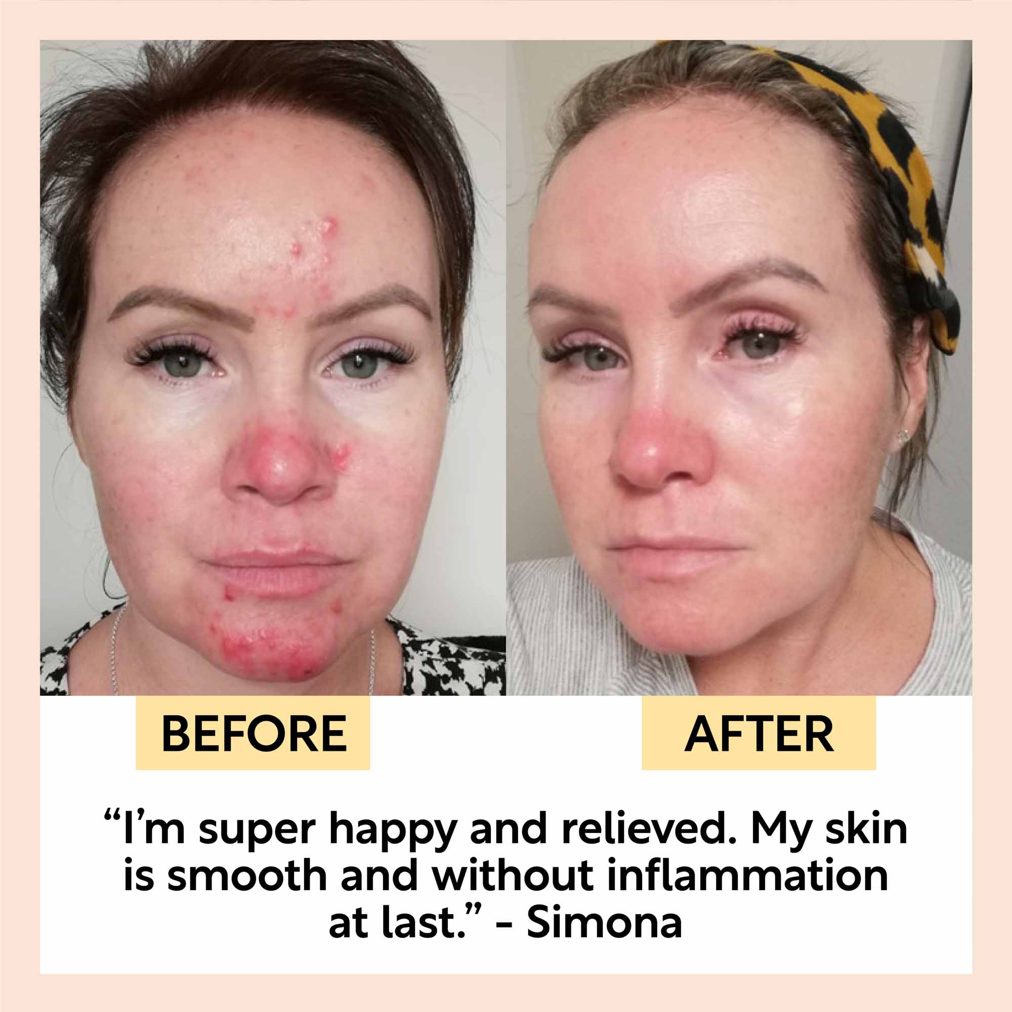 The Sensitive Skin Bundle